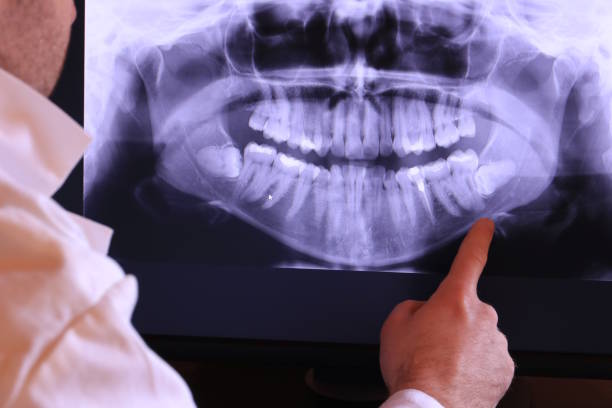 Best Mobile Emergency Dentist in West Springfield, VA