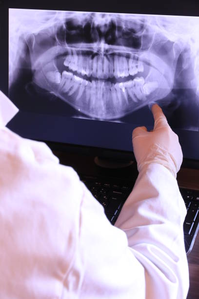 Best Emergency Dental Extractions in West Springfield, VA